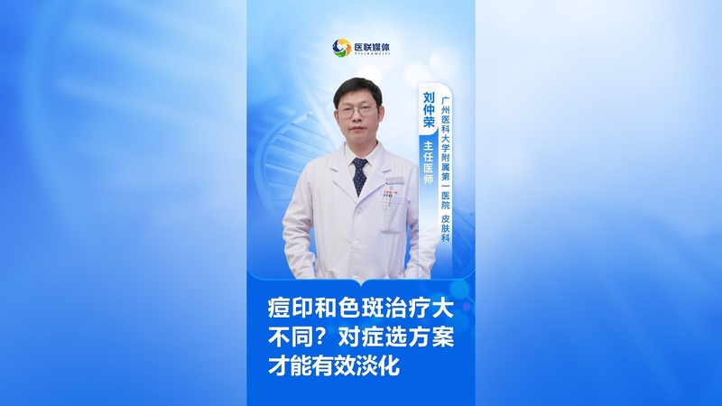 痘印和色斑治疗大不同？对症选方案才能有效淡化