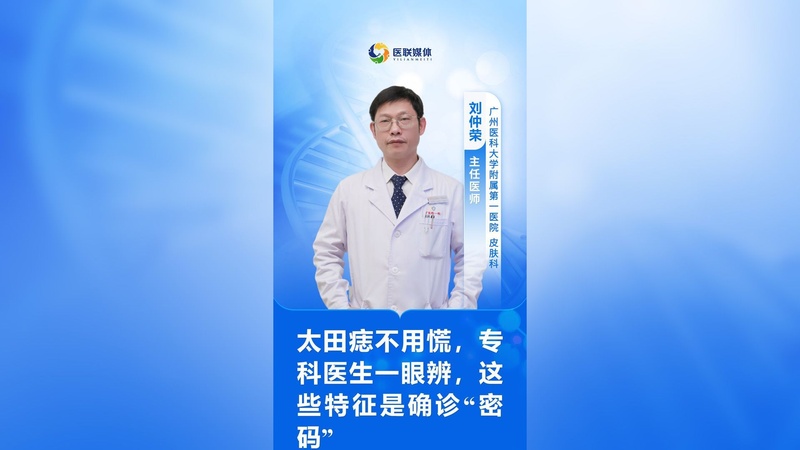 太田痣不用慌，专科医生一眼辨，这些特征是确诊“密码”