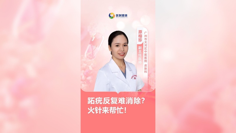 跖疣反复难消除?火针来帮忙!