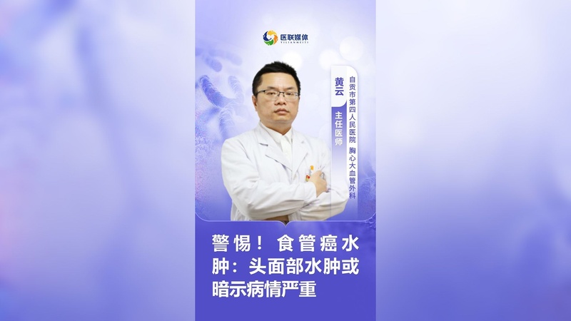警惕！食管癌水肿：头面部水肿或暗示病情严重