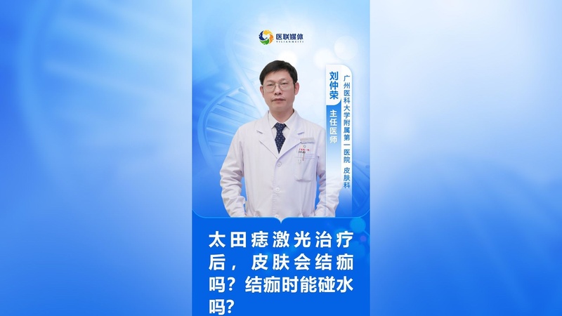 太田痣激光治疗后,皮肤会结痂吗?结痂时能碰水吗?