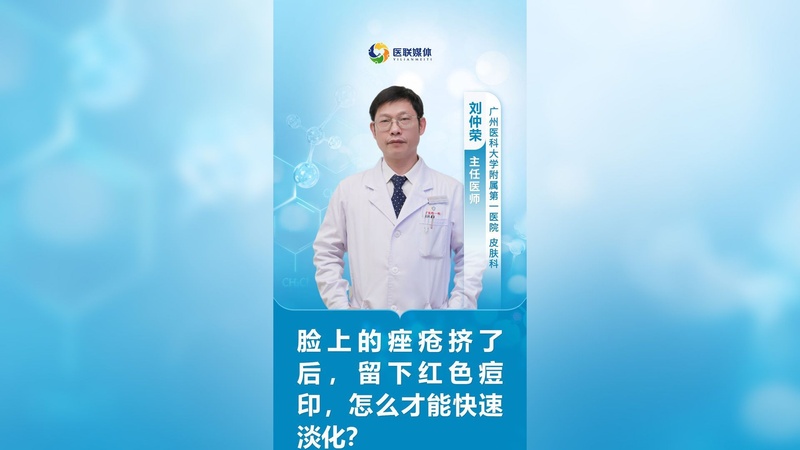 脸上的痤疮挤了后,留下红色痘印,怎么才能快速淡化?