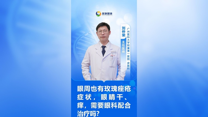 眼周也有玫瑰痤疮症状,眼睛干、痒,需要眼科配合治疗吗?