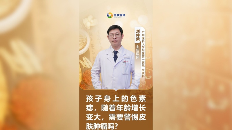 孩子身上的色素痣,随着年龄增长变大,需要警惕皮肤肿瘤吗?