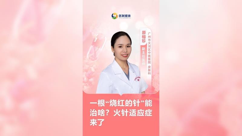 一根“燒紅的針”能治啥？火針適應癥來了