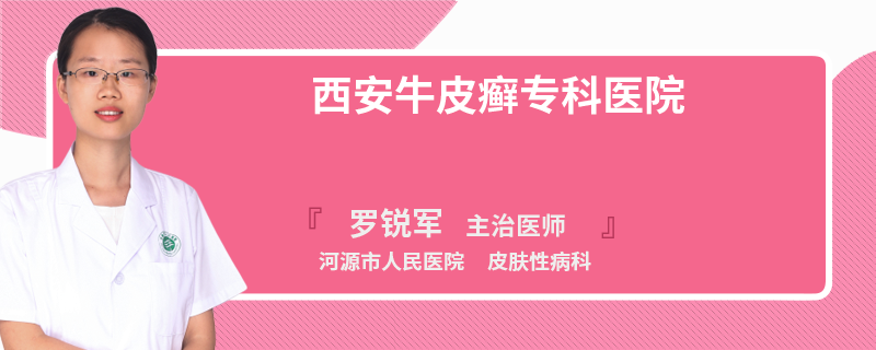 西安牛皮癬?？漆t(yī)院