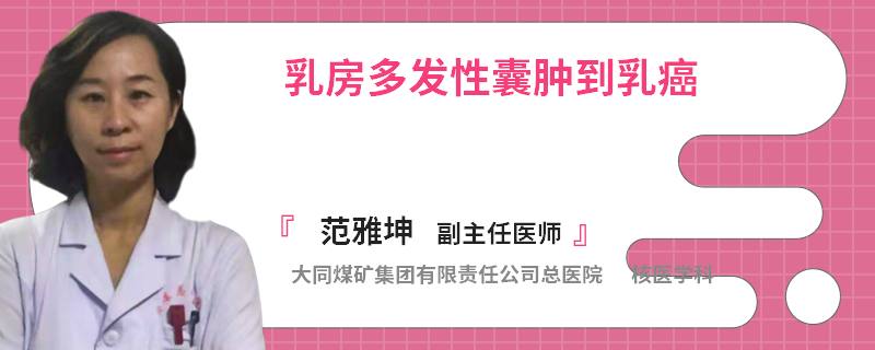 乳房多發(fā)性囊腫到乳癌