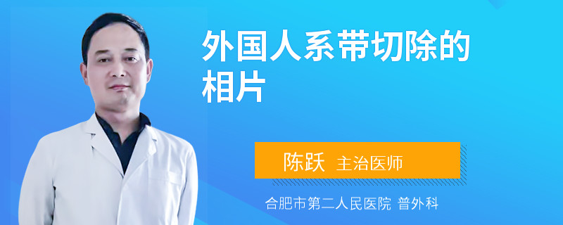 外国人系带切除的相片