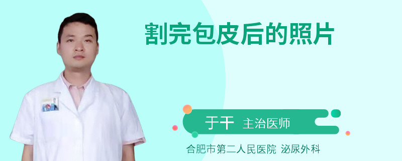 割完包皮后的照片