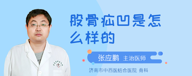 股骨疝凹是怎么样的