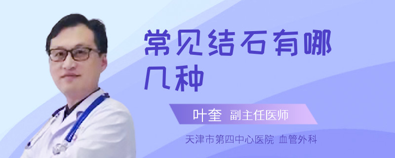 常見結石有哪幾種