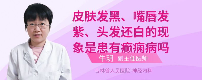 皮膚發(fā)黑、嘴唇發(fā)紫、頭發(fā)還白的現(xiàn)象是患有癲癇病嗎