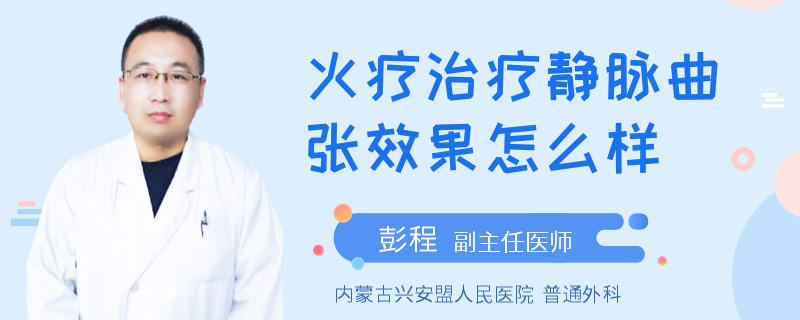 火療治療靜脈曲張效果怎么樣