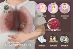 小儿支气管肺炎