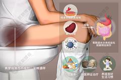 大便粘腻