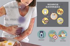 食物过敏