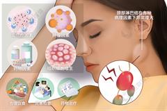 颈部淋巴结肿大