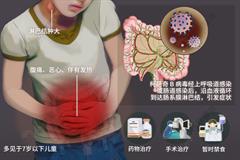 肠系膜淋巴结炎