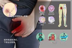 腹股沟淋巴结肿大