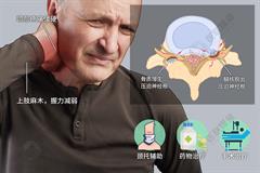 神经根型颈椎病
