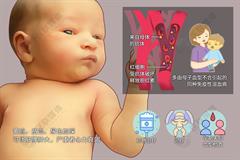 新生儿溶血