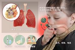 小儿肺炎