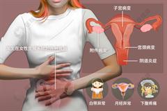 妇科病