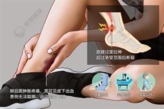 跟腱断裂