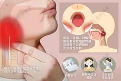 慢性咽喉炎