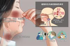 萎缩性鼻炎