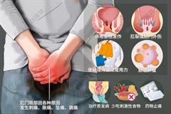 肛门疼痛