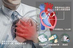 一度房室传导阻滞