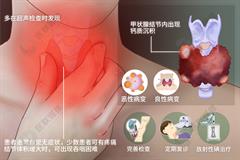 甲状腺结节钙化