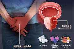 慢性前列腺炎