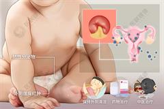 婴幼儿阴道炎