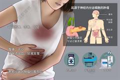 神经内分泌肿瘤