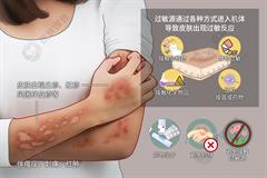 过敏性皮肤病
