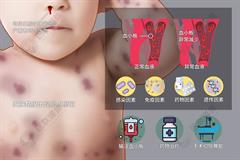 血小板减少性紫癜