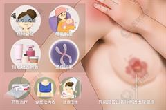 乳房湿疹