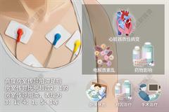 高度房室传导阻滞