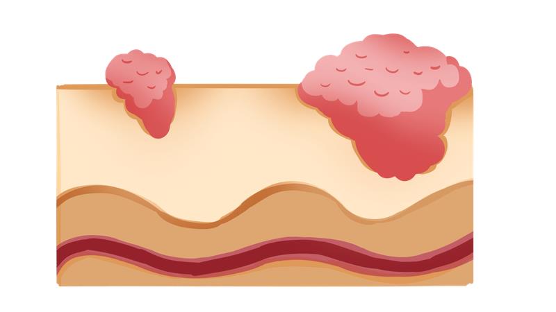 免疫治疗疗效毒性“解偶联”新靶点获揭示 开创“主动预防”新策略