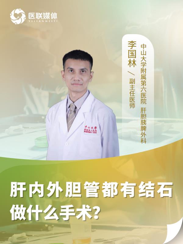 肝内外胆管都有结石做什么手术？