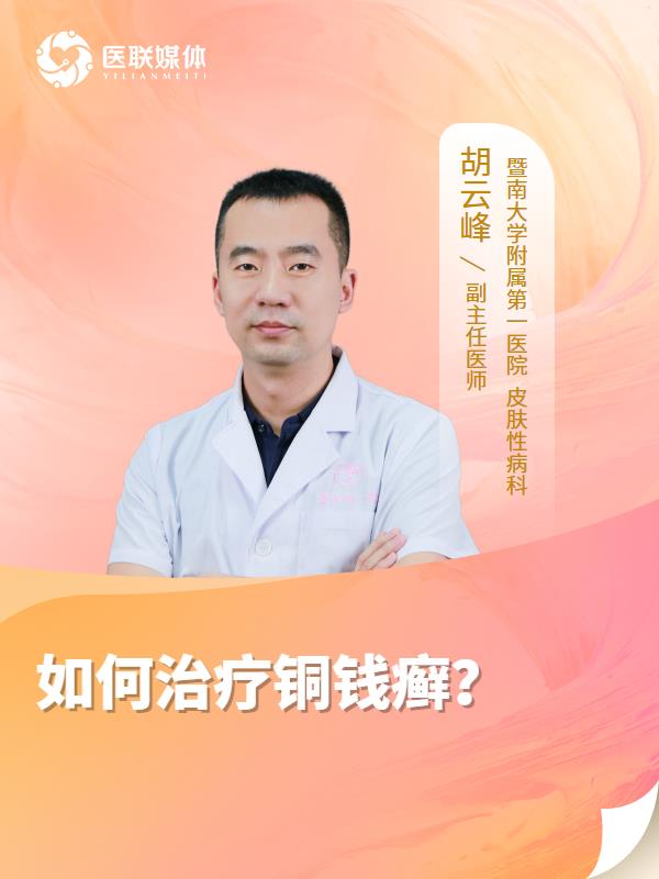 如何治疗铜钱癣？