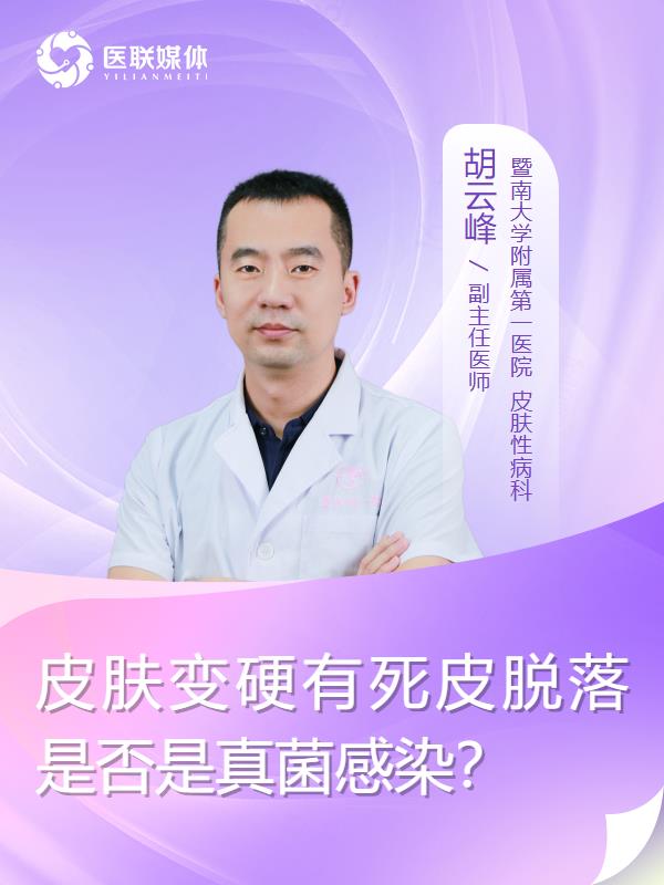 皮肤变硬有死皮脱落是否是真菌感染？