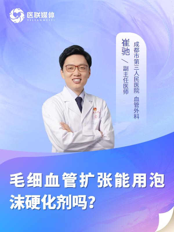 毛细血管扩张能用泡沫硬化剂吗？