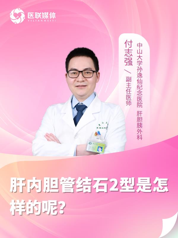 肝内胆管结石2型是怎样的呢？