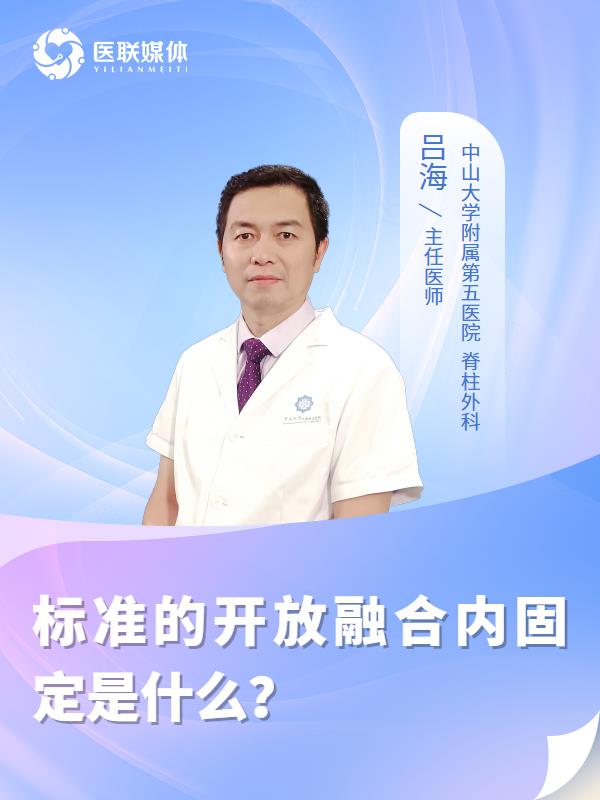 标准的开放融合内固定是什么？