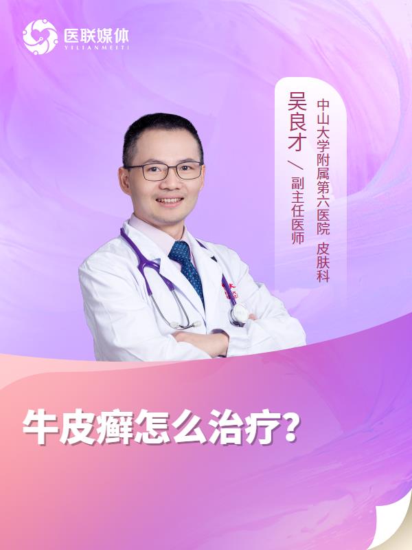 牛皮癣怎么治疗？