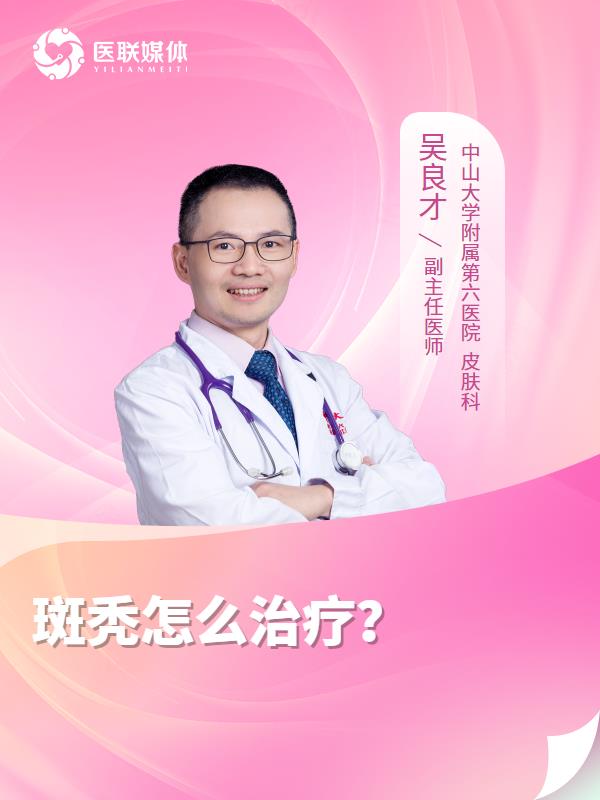 斑秃怎么治疗？