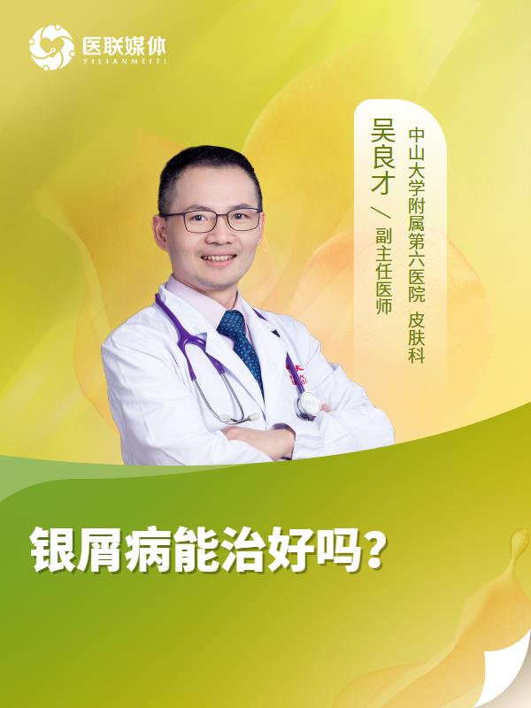 银屑病能治好吗？